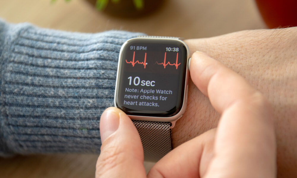 Apple watch